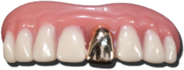 Billy bob full grill gold gebit